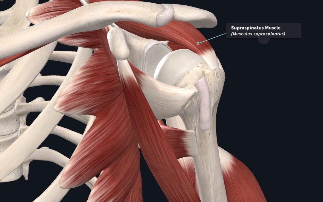 Shoulder Impingement | Dr. Abbate Physical Therapy